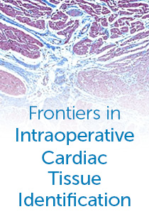 Frontiers in Intraoperative Cardiac Tissue Identification Banner
